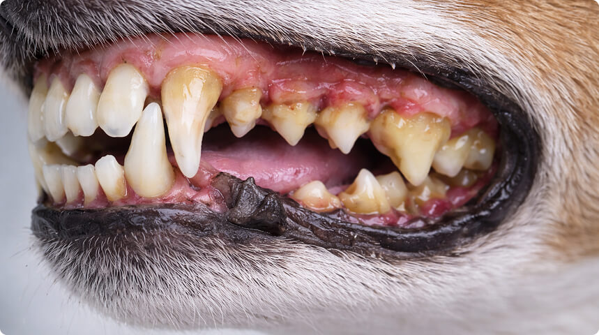 крупный план зубов с гингивитом